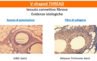 Fili in PDO - Intervento teorico 2 - video