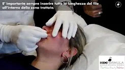 Video trattamento fili PDO_2